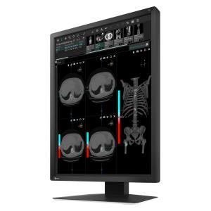 EIZO RadiForce MX217-SB Monitor medicale da consultazione