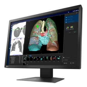 Monitor medicale EIZO RadiForce MX243W da consultazione - 24,1"