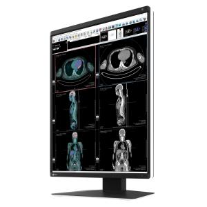 medicale Eizo RX370 RadiForce