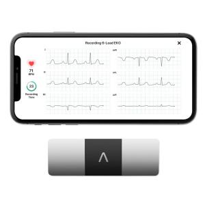 KardiaMobile 6L - ECG tascabile a 6 derivazioni distribuito da OMRON