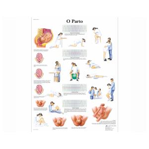 Póster laminado 50 × 67 cm -  O Parto