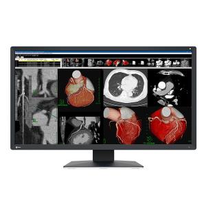 medicale EIZO RadiForce MX317W da consultazione - 30,5