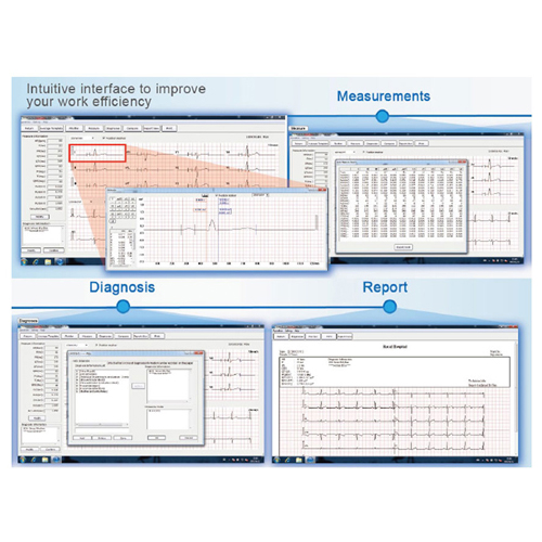 Software visualización ecg para Smart y VE-100 / VE-300