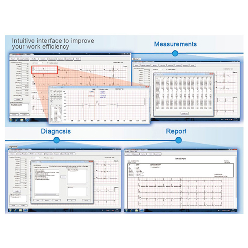 visualizzazione per ecg EDAN e VE-100/VE-300