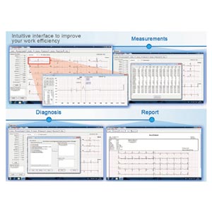 visualización ecg para Smart y VE-100 / VE-300