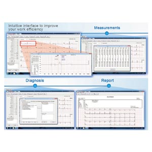 visualizzazione per ecg EDAN e VE-100/VE-300