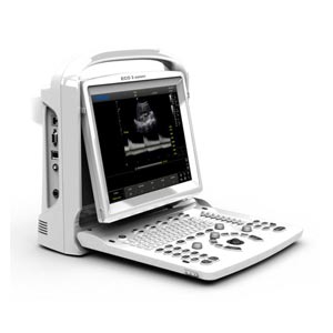 portatile Chison ECO3 Expert bianco/nero con doppler - senza sonde