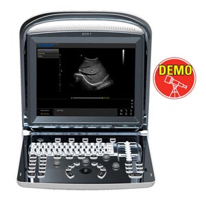 Ecocolordoppler portatile Chison ECO5 - senza sonde - outlet
