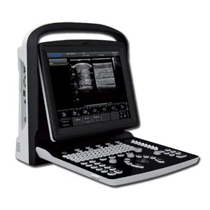 Echographe portable Chison ECO3 Expert VET noir et blanc avec doppler - sans sonde