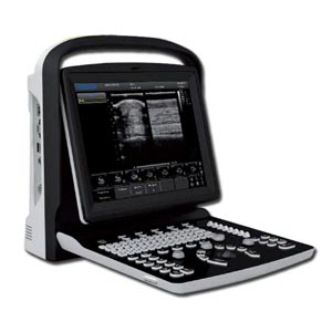 Ecógrafo portátil Chison ECO3 Expert VET blanco/negro con doppler - sin sondas