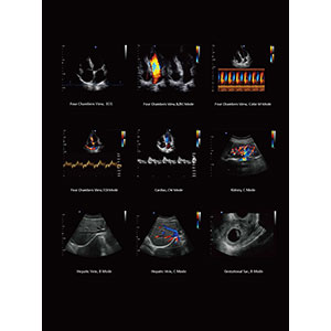 Ecocolordoppler Chison QBit5 - sin sondas