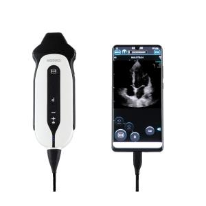 portátil Chison SonoEye 