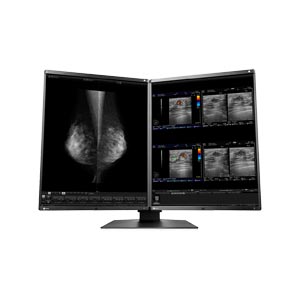 Monitor medicale Eizo RX560-MD RadiForce