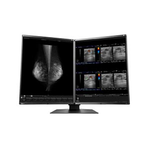 medicale Eizo RX560-MD RadiForce