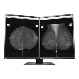 Monitor medicale Eizo GX560-MD RadiForce