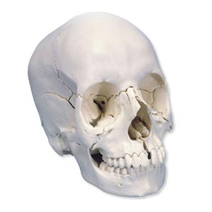 Cranio scomponibile in 22 parti 3B Scientific® - versione anatomica