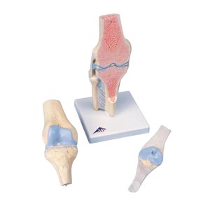 Ginocchio: sezione articolare - in tre parti