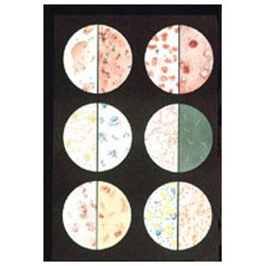 Tavola da muro 84 × 118 cm - Batteri 