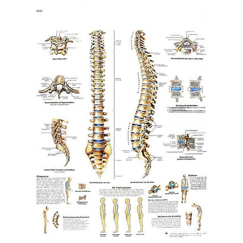 Acquista Poster laminato 50 x 67 cm - Colonna vertebrale: anatomia e  patologia, Doctor Shop