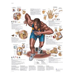laminato 50 × 67 cm - Lesioni in seguito ad attività sportive