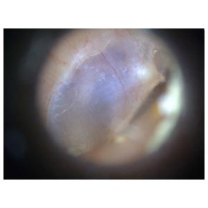 Vídeo Otoscópio Dino-Lite EarScope Basic