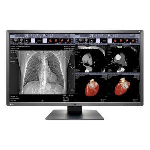 Monitor medicale da consultazione EIZO RadiForce MX315W - 31,1