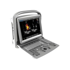 Chison ECO6 ecocolordoppler portatile - senza sonde