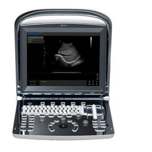 Ecógrafo color doppler Chison ECO5 portátil con sonda linear 7,5 MHz 40 mm