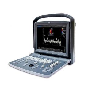 Ecocolordoppler portátil Chison ECO5 - con sonda convex 3,5 MHz 60 mm