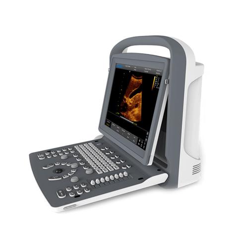Chison ECO2 portable à ultrasons – sans sonde