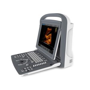 Echographe Chison ECO2 portable à ultrasons – sans sonde