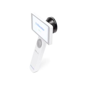 Lente de dermatología para Riester RCS-100
